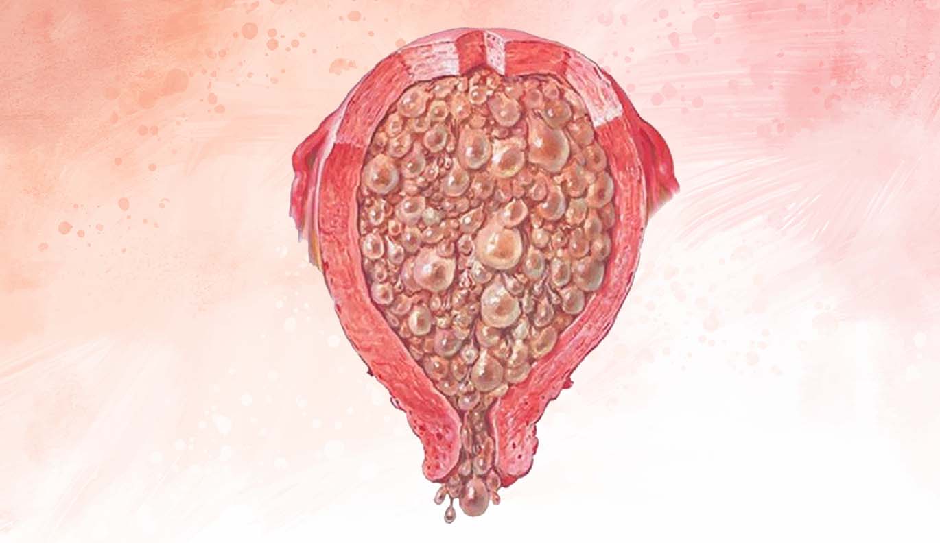 Mol Gebelik Caglarhelvacioglu