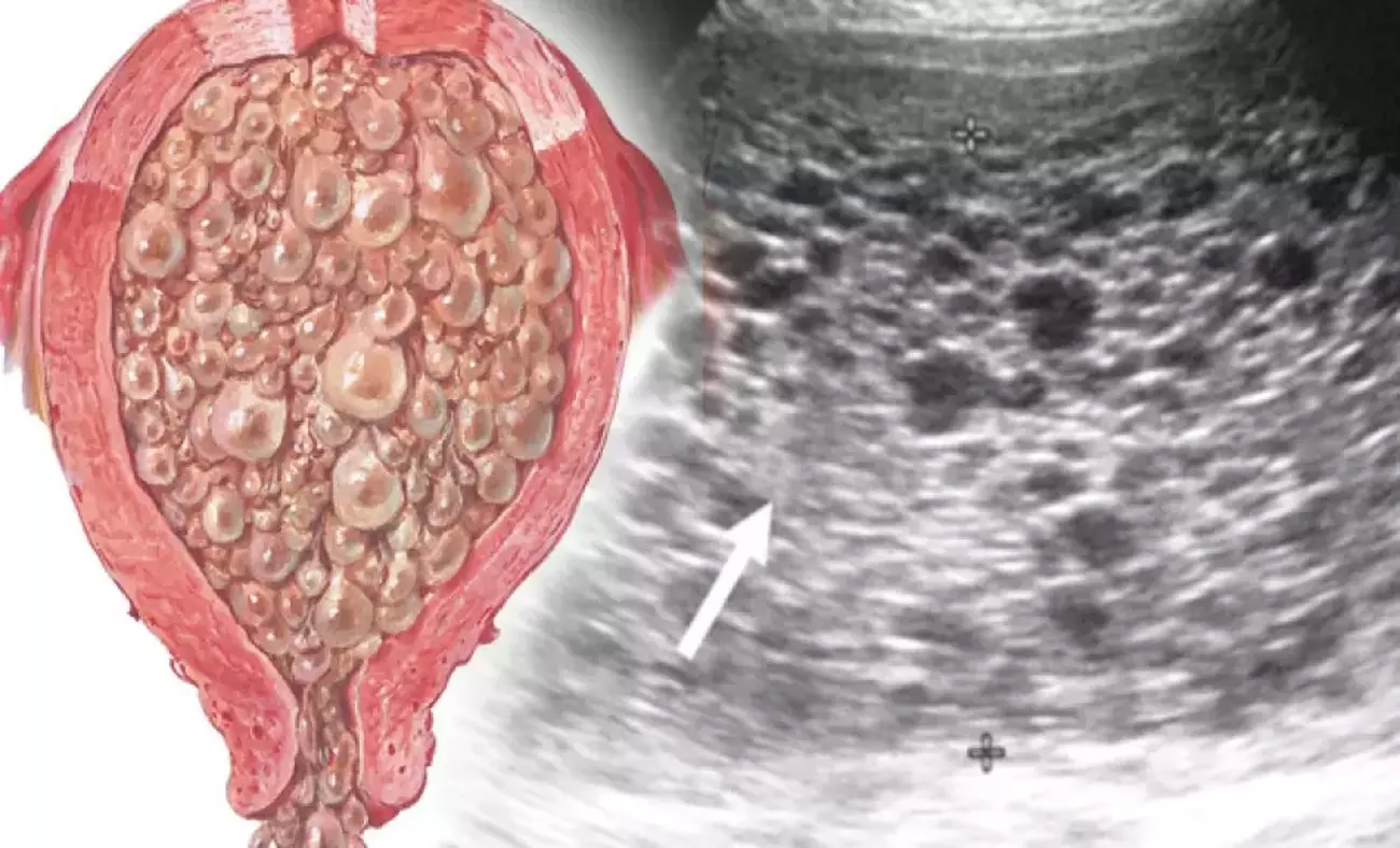 Mol Gebelik Nedir Tedavisi Nasildir 1580300798 6168