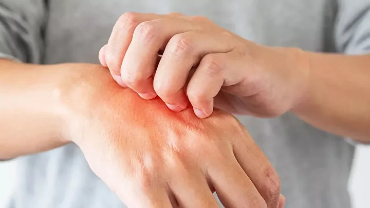 934681C0 Soguk Isirmasi6