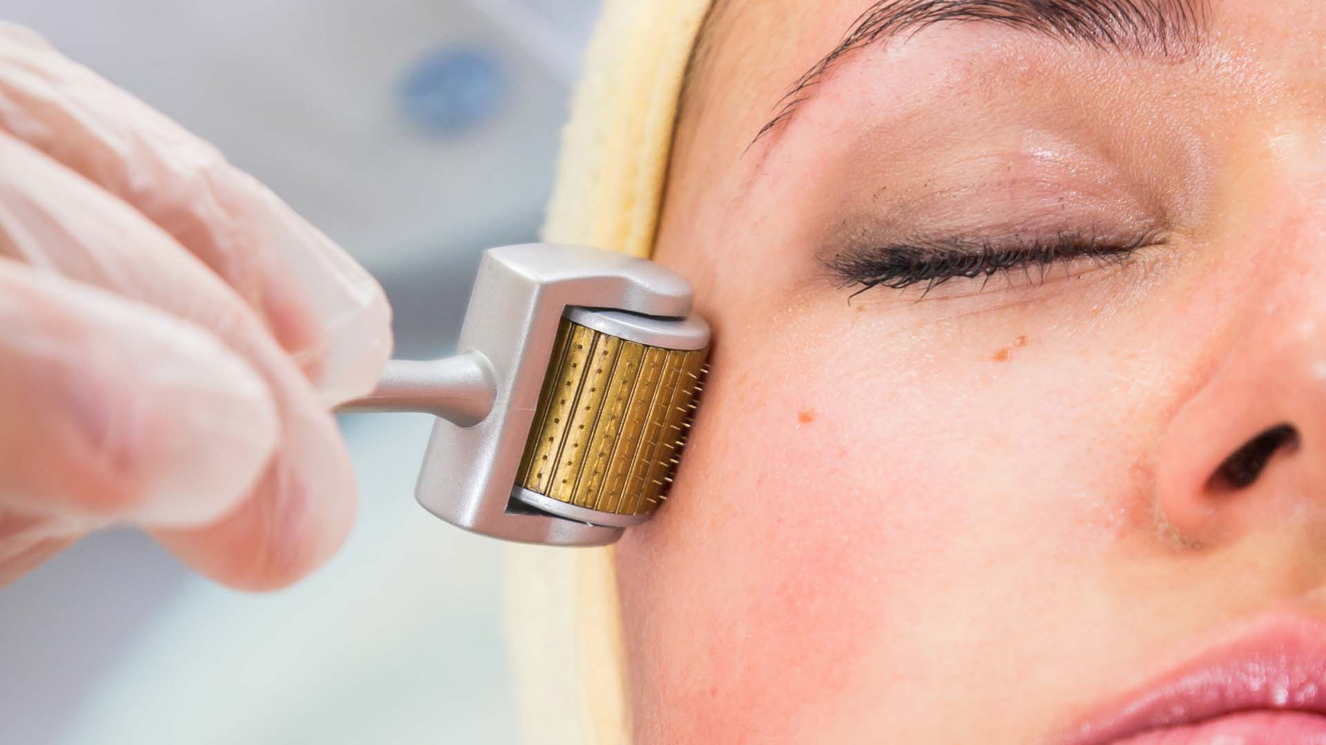 Blog Featured Icerik181