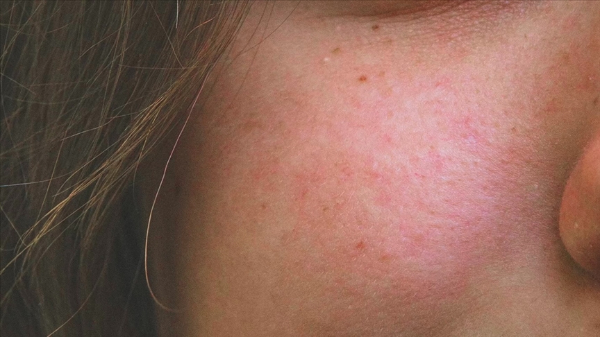 Thumbs B C Ff3F13Feea046B8F71Dcf6C9D11Ab8A0