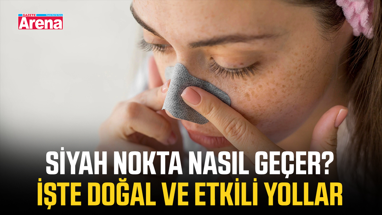 Siyah nokta nasıl geçer? İşte doğal ve etkili yollar