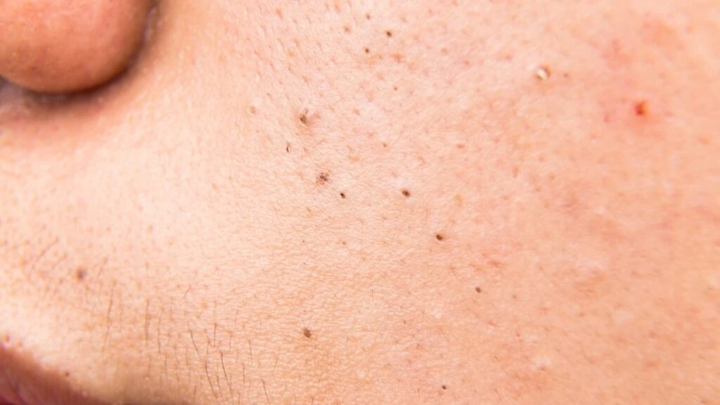 Siyah Nokta 2 1024X576