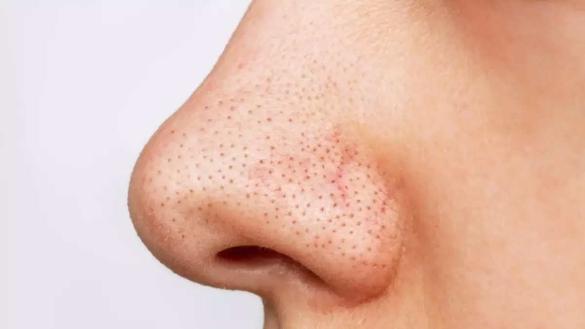 Siyah Nokta Neden Olur Evde Siyah Noktalar Nasil 16283668 366 Amp