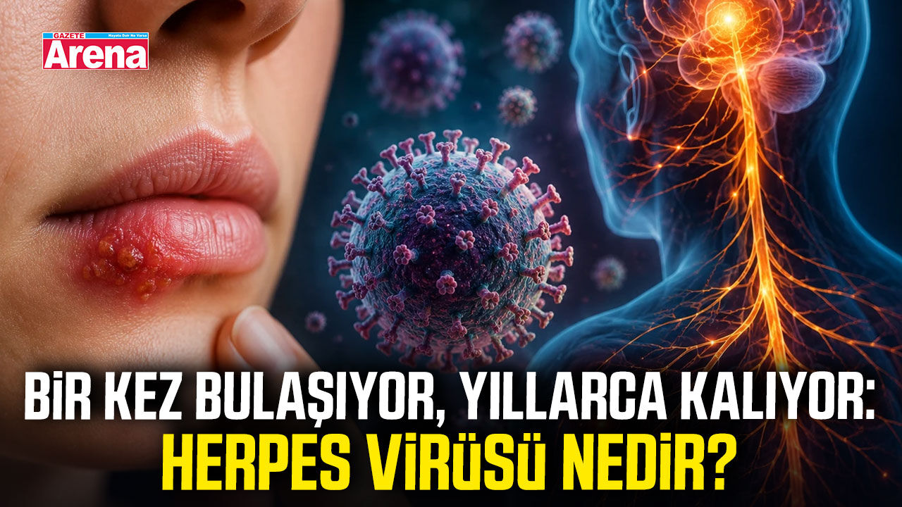Bir kez bulaşıyor, yıllarca kalıyor: Herpes virüsü nedir?