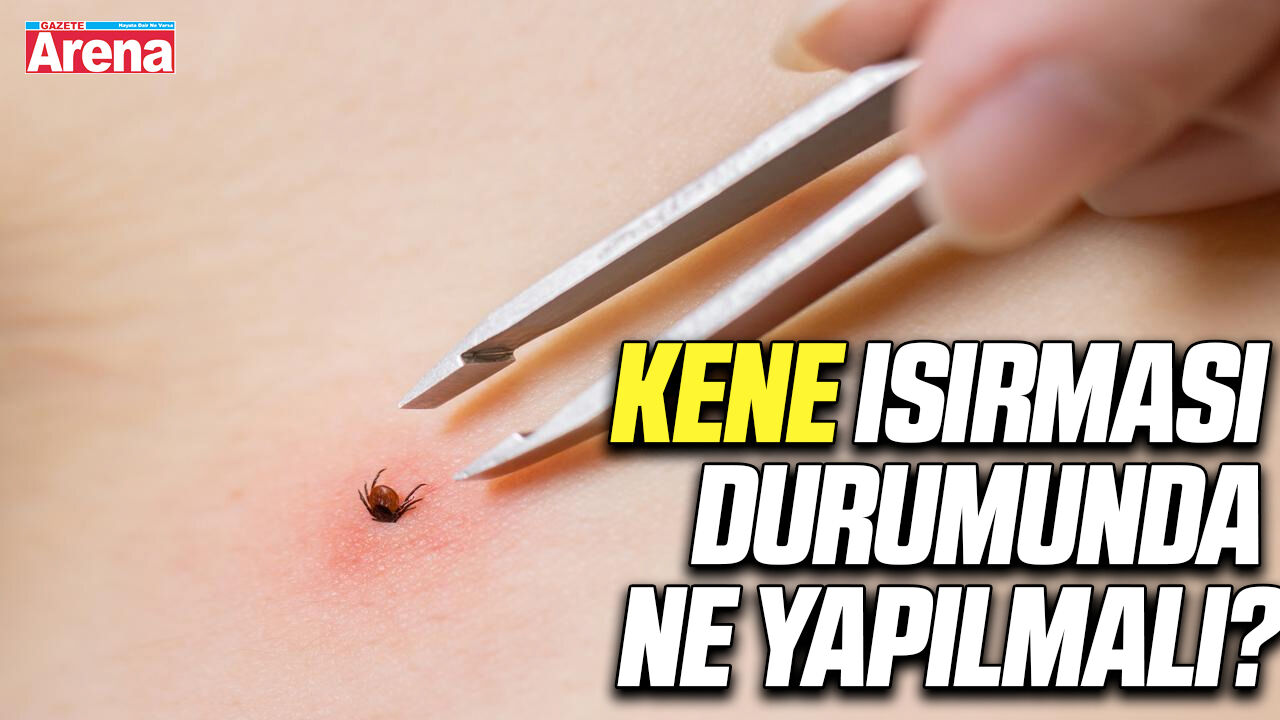 Kene ısırması durumunda ne yapılmalı?