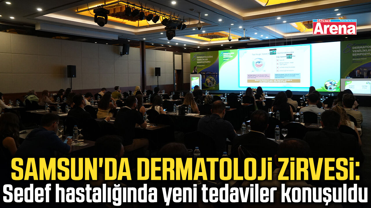 Sedef hastalığında erken tedavi hayat kurtarıyor