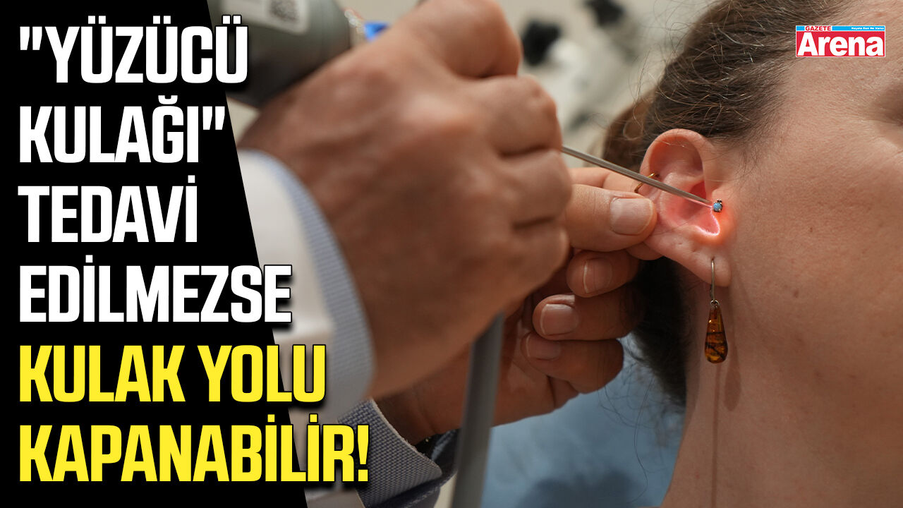 "Yüzücü kulağı" tedavi edilmezse kulak yolu kapanabilir!