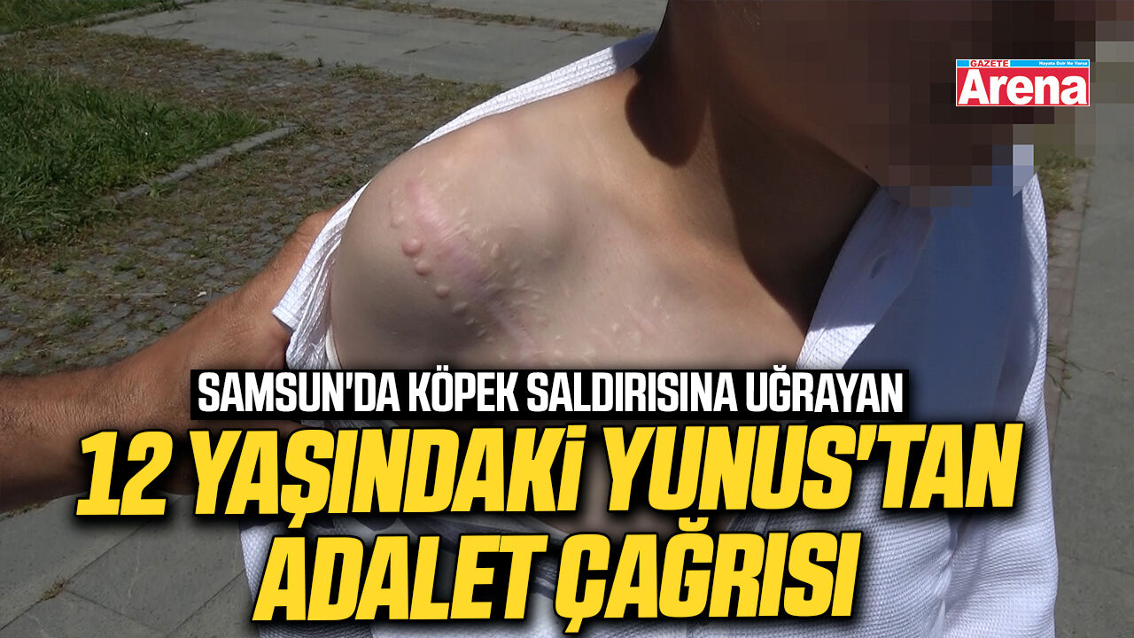Samsun'da köpek saldırısına uğrayan 12 yaşındaki Yunus'tan adalet çağrısı