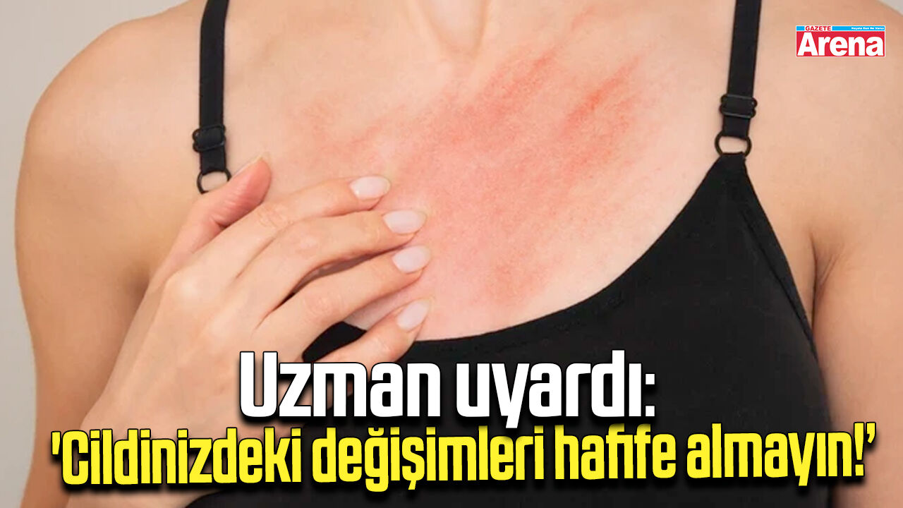 Uzman uyardı: 'Cildinizdeki değişimleri hafife almayın!'
