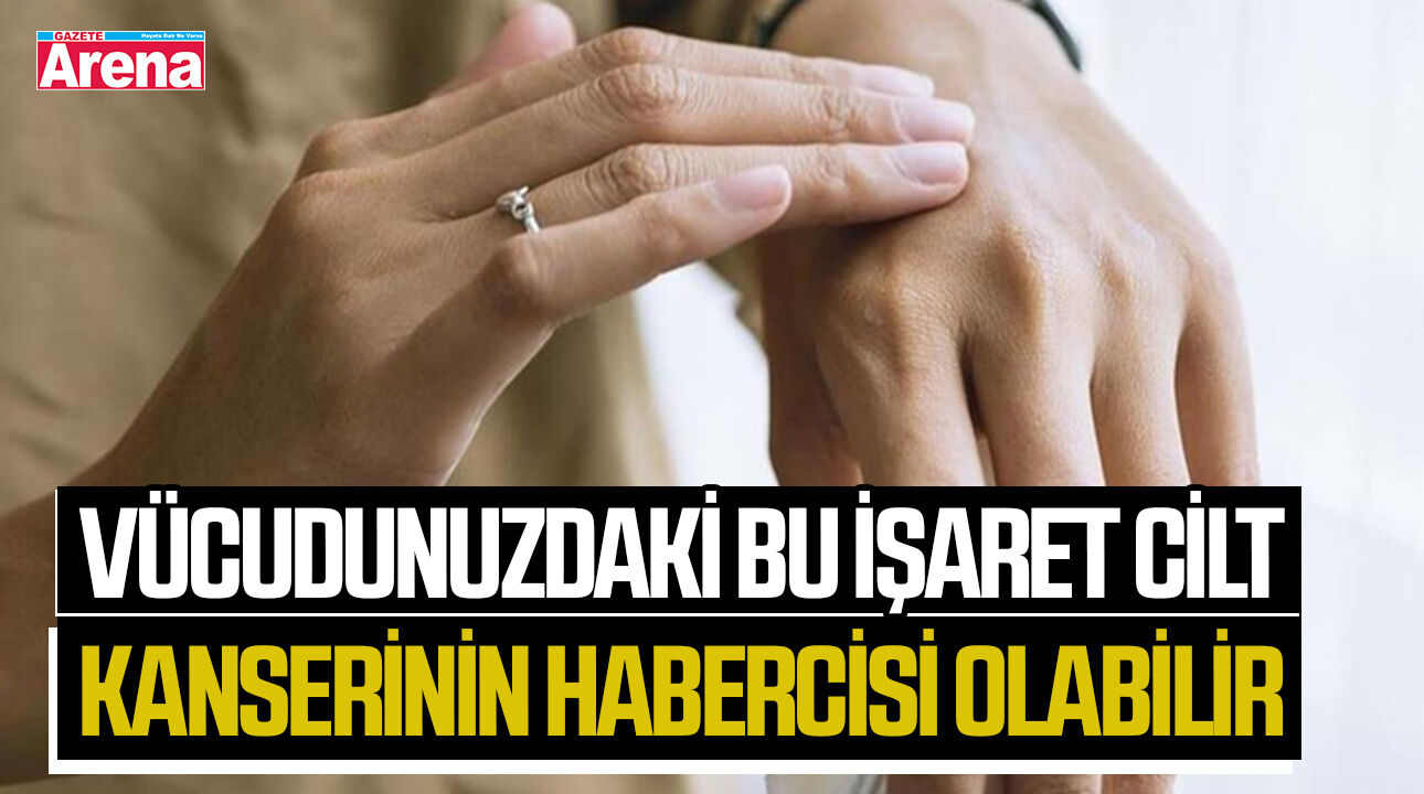 Vücudunuzdaki bu işaret cilt kanserinin habercisi olabilir