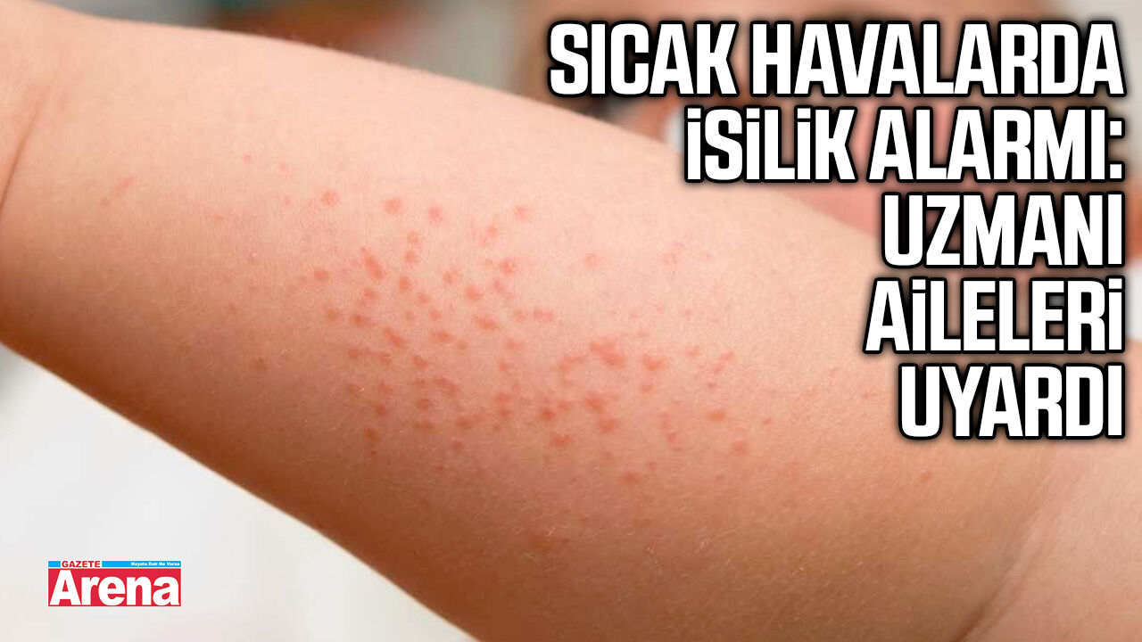 Sıcak havalarda isilik alarmı: Uzmanı aileleri uyardı
