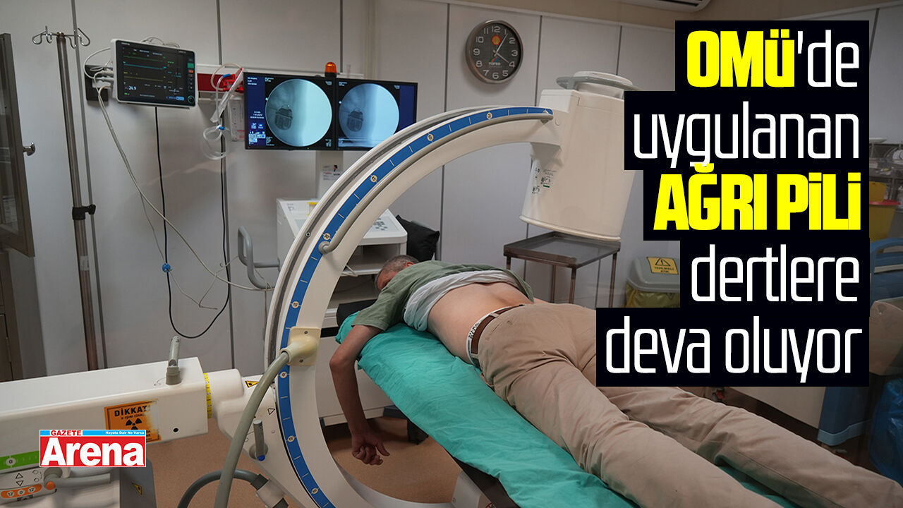 OMÜ'de uygulanan ağrı pili dertlere deva oluyor