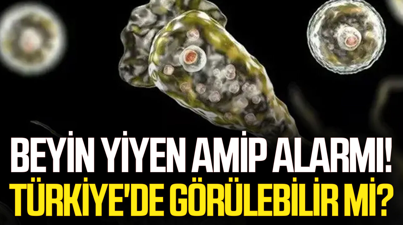 Beyin yiyen amip alarmı! Türkiye'de görülebilir mi?