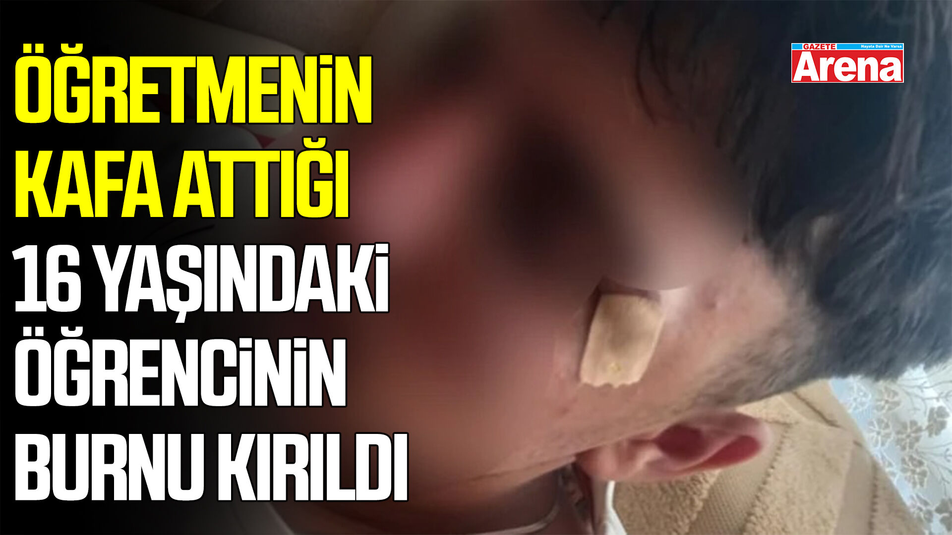 Öğretmenin kafa attığı 16 yaşındaki öğrencinin burnu kırıldı